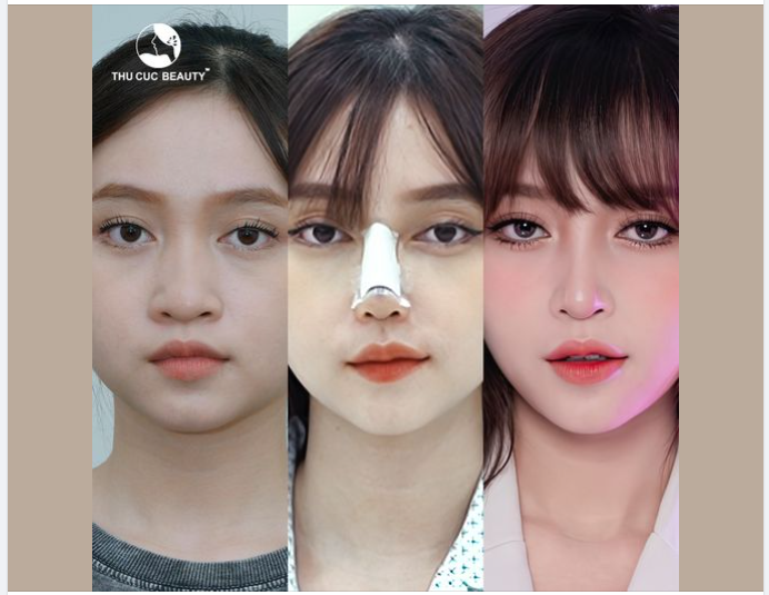 NÂNG MŨI GIÁ GỐC - TUẦN LỄ TÁI SINH
