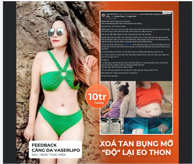 U40 "LỘT XÁC" SAU PHẪU THUẬT HÚT MỠ CĂNG DA BỤNG.
