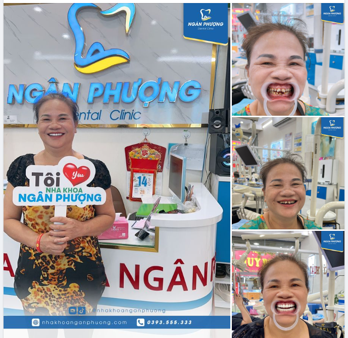 Chúc mừng cô đã có được nụ cười mơ ước, đồng thời răng miệng khỏe mạnh và ăn uống, sinh hoạt tự tin hơn trước nhiều lần