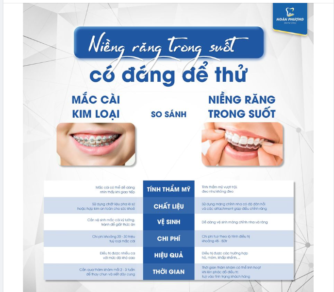 Nếu bạn ưu tiên MẮC CÀI KIM LOẠI. Nếu bạn chọn Niềng răng trong suốt