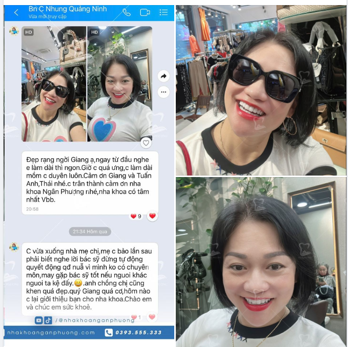 Chị Nhung là khách hàng khó tính bậc nhất của nha khoa.