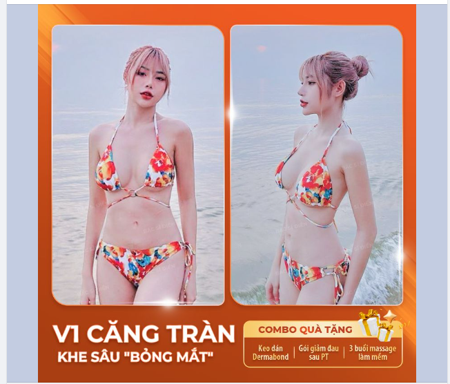 V1 CĂNG TRÀN - KHE SÂU "BỎNG MẮT"  Không còn tự ti vì "TRƯỚC SAU NHƯ MỘT"