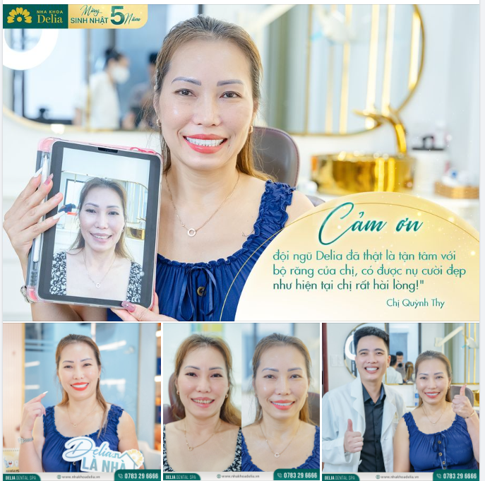 Mình rất hài lòng với nụ cười hiện tại. Cảm ơn đội ngũ Delia đã thật là tận tâm với bộ răng của chị, có được nụ cười đẹp như hiện tại chị rất hài lòng