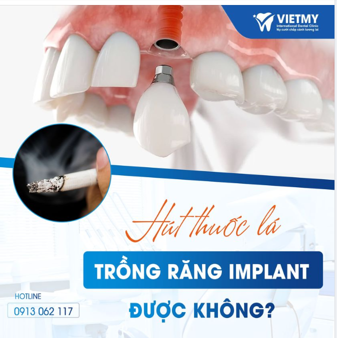 Hút Thuốc Lá và Khả năng Trồng Răng Implant: Điều Bạn Cần Biết