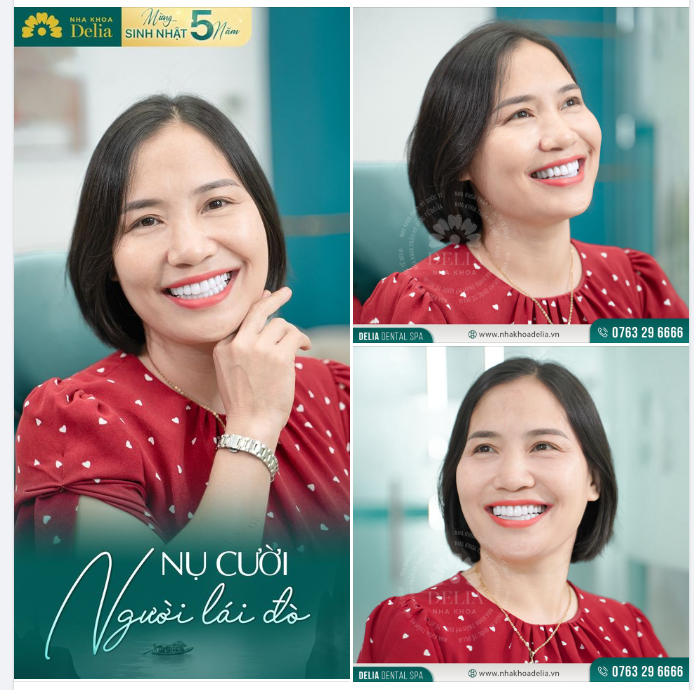 Thẩm mỹ răng sứ - Kiến tạo nụ cười “người lái đò” vùng cao