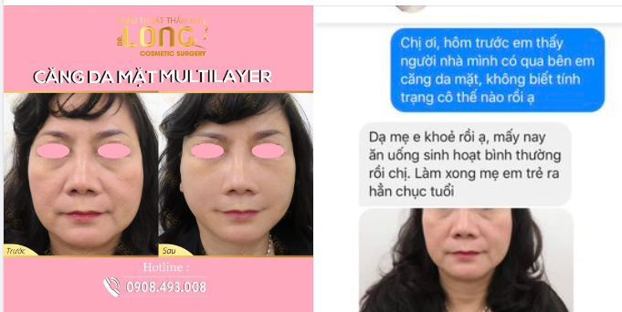 ƯU ĐÃI GIẢM SÂU KHI CĂNG DA MẶT MULTILAYER CHỈ TỪ 30 TRIỆU