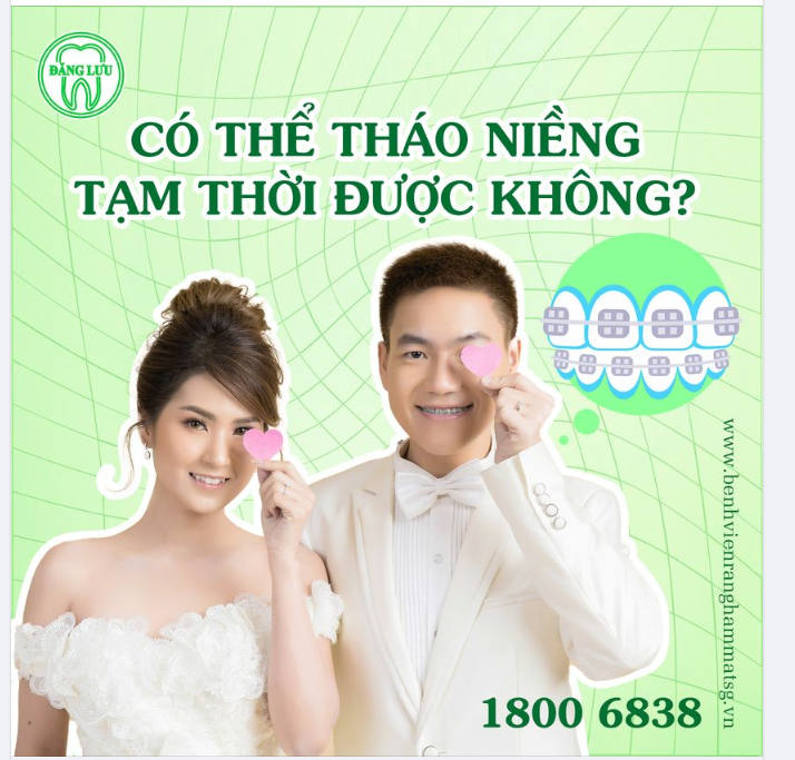 Đang Niềng Răng Nhưng Nếu Có Sự Kiện Quan Trọng Thì Có Thể Tạm Thời Tháo Rời Được Không?