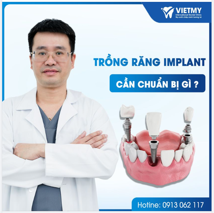 TRỒNG RĂNG IMPLANT CẦN CHUẨN BỊ NHỮNG GÌ?