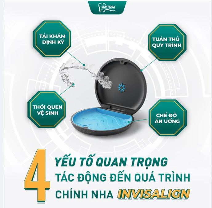 4 YẾU TỐ QUAN TRỌNG TÁC ĐỘNG ĐẾN QUÁ TRÌNH CHỈNH NHA INVISALIGN