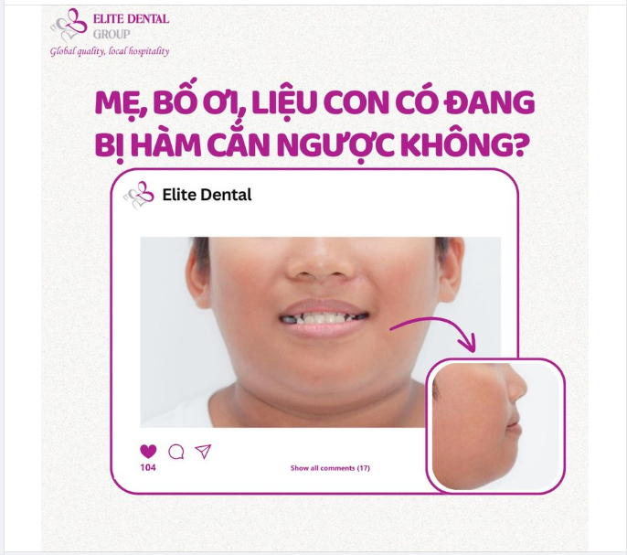 MẸ, BỐ ƠI, LIỆU CON CÓ ĐANG BỊ HÀM CẮN NGƯỢC KHÔNG?