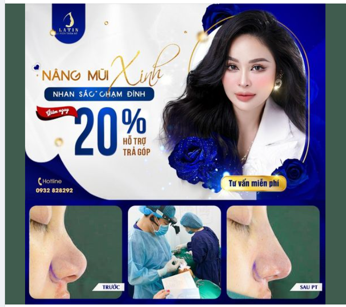 NÂNG MŨI XINH - NHAN SẮC CHẠM ĐỈNH