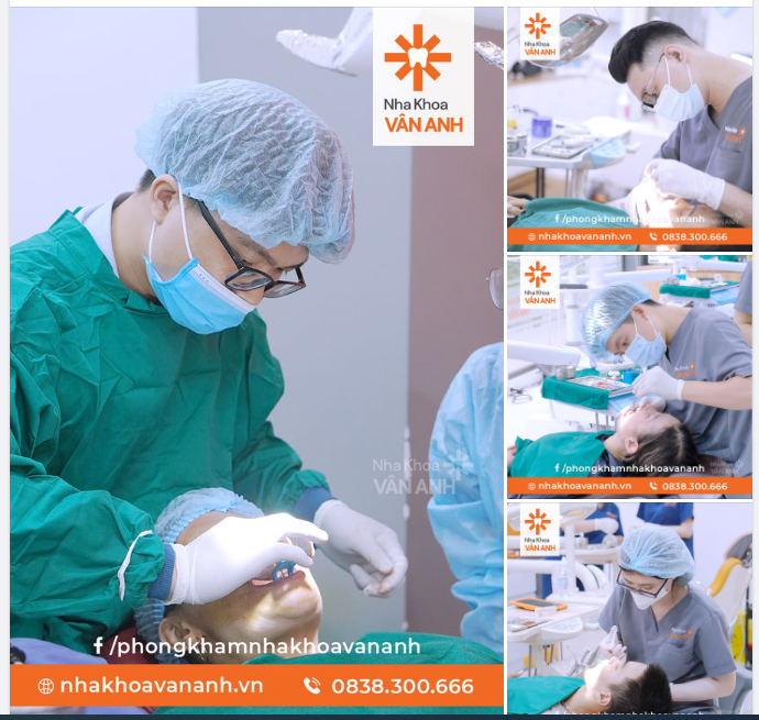 TAY NGHỀ BÁC SĨ - YẾU TỐ TIÊN QUYẾT DẪN ĐẾN THÀNH CÔNG CỦA CA TRỒNG RĂNG IMPLANT