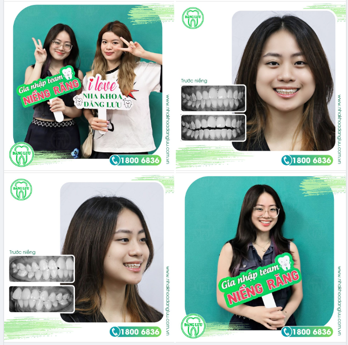 CHÀO MỪNG TÂN NIỀNG-ER | Invisalign
