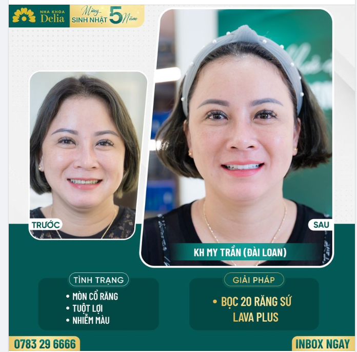 Răng khoẻ đẹp - Tự tin khoe nụ cười rạng rỡ