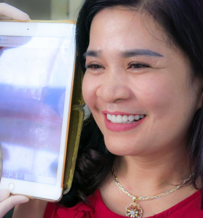Nguyên nhân khiến ngà răng bị lộ