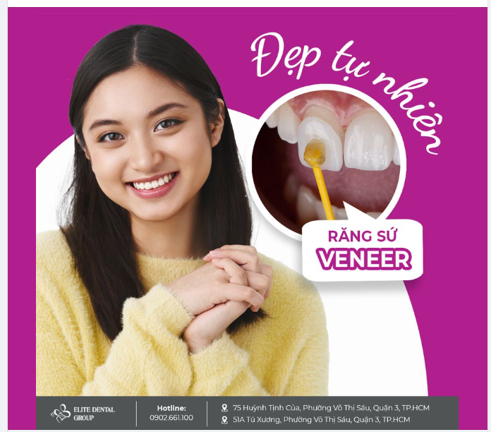 ĐẸP TỰ NHIÊN VỚI RĂNG SỨ VENEER