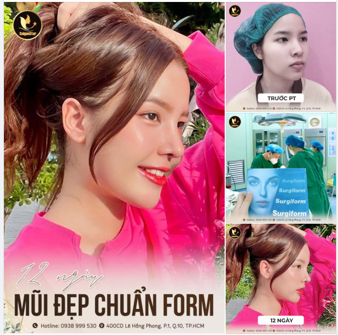 12 NGÀY MŨI ĐẸP CHUẨN FORM