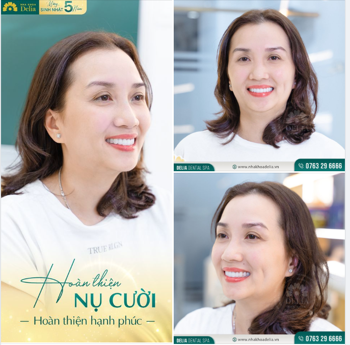 Hoàn thiện nụ cười - Hoàn thiện hạnh phúc