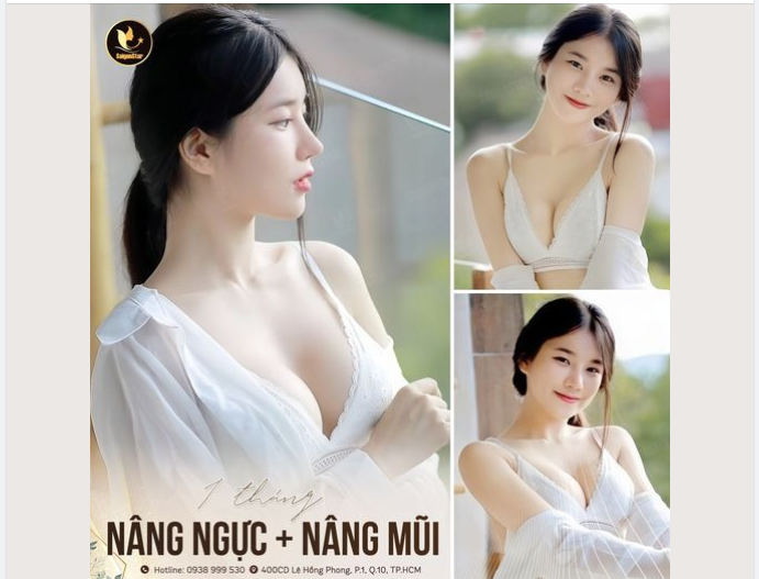 Khoe với cả nhà hình ảnh bạn khách sau 1 tháng thực hiện combo nâng mũi kết hợp nâng ngực.