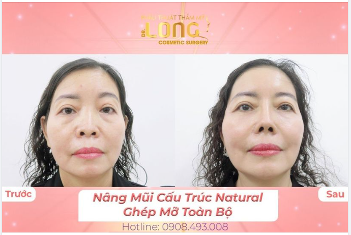 BẰNG TUỔI NHAU MÀ SAO CÔ ẤY TRẺ QUÁ…ƯỚC GÌ…???
