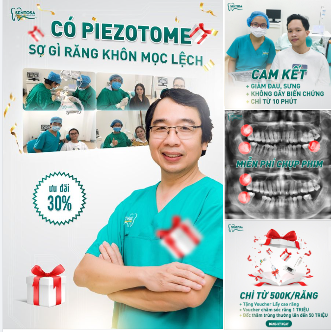 CÓ PIEZOTOME, SỢ GÌ RĂNG KHÔN MỌC LỆCH