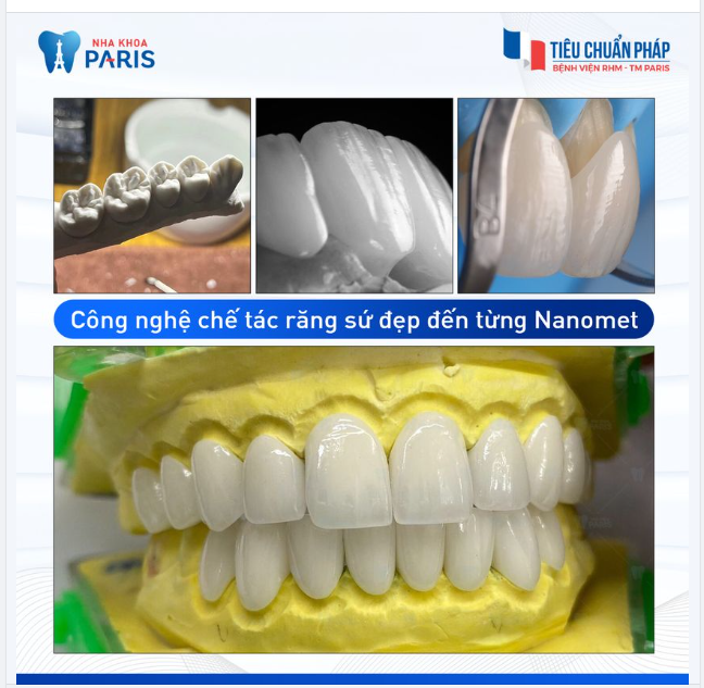 CAD/CAM - Công nghệ chế tác răng sứ đẹp đến từng Nanomet!