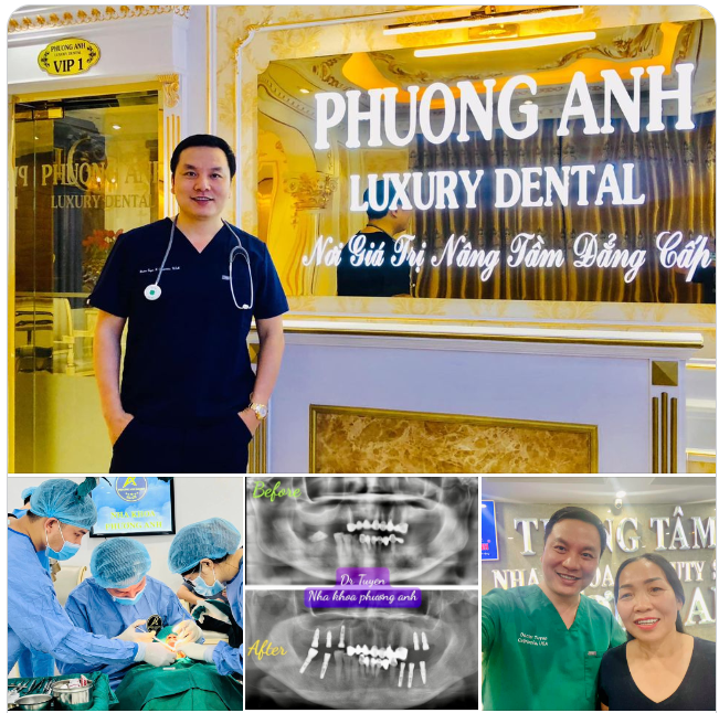 Sau gần 2h phẫu thuật kết hợp giữa khí cụ cấy ghép truyền thống với nong xương, trẻ xương, nâng xoang kín bằng máy từ tính … kết quả ngoài mong đợi của cả BN và bác sĩ