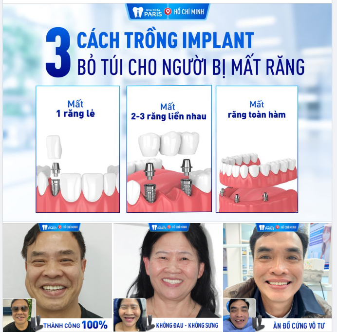 MẤT RĂNG, TRỒNG LẠI BẰNG CÁCH NÀO?