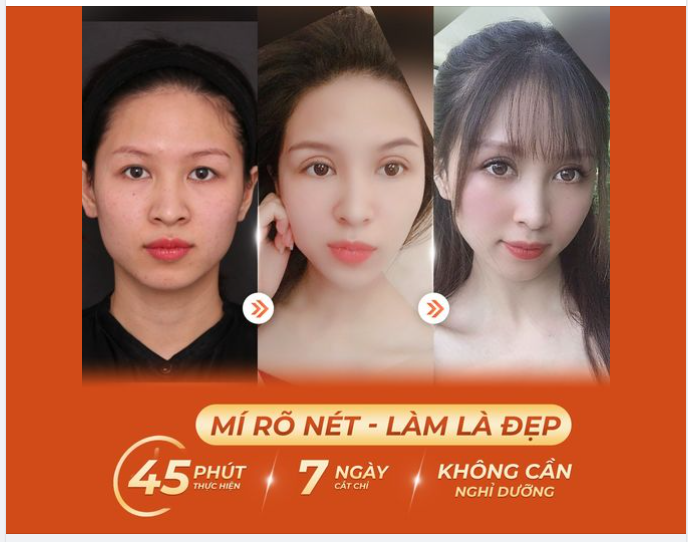 MÍ RÕ NÉT - LÀM LÀ ĐẸP