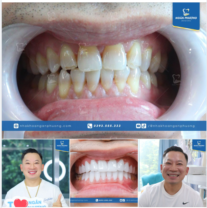 Anh Johnny - Việt Kiều Mỹ chia sẻ suy nghĩ về việc làm sứ. Đúng là đàn ông hiện đại, đâu ngại bảnh bao ​​​​​​​