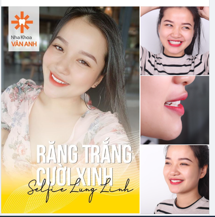 ĐẸP TỰ NHIÊN NHƯNG KHÔNG TỰ NHIÊN MÀ CÓ