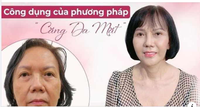BẠN ĐANG QUAN TÂM ĐẾN PHƯƠNG PHÁP CĂNG DA MẶT
