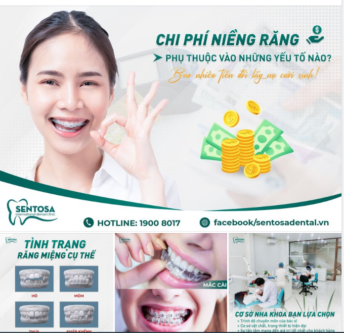 NIỀNG RĂNG MẤT KHOẢNG BAO NHIÊU TIỀN