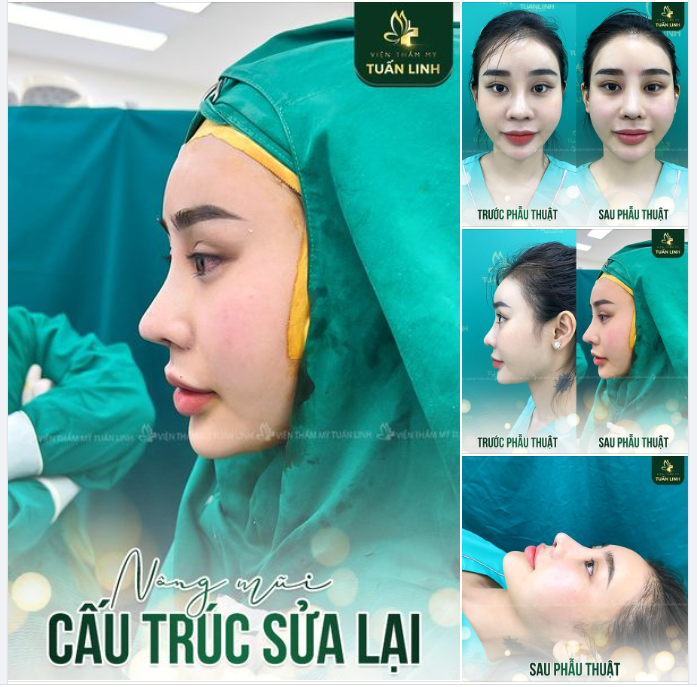 SỰ KHÁC BIỆT NẰM Ở ĐỘ DÀI ĐẦU MŨI!!
