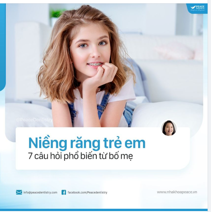  NIỀNG RĂNG TRẺ EM
