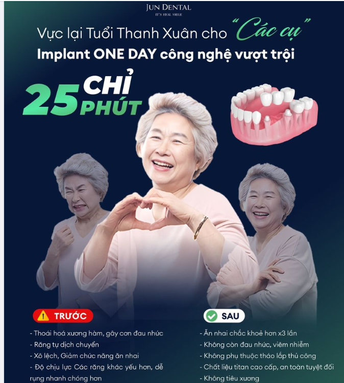 Thay thế Răng đã mất bằng Răng Implant là gì ? Những ai có thể sử dụng liệu pháp điều trị khoa học này ?]
