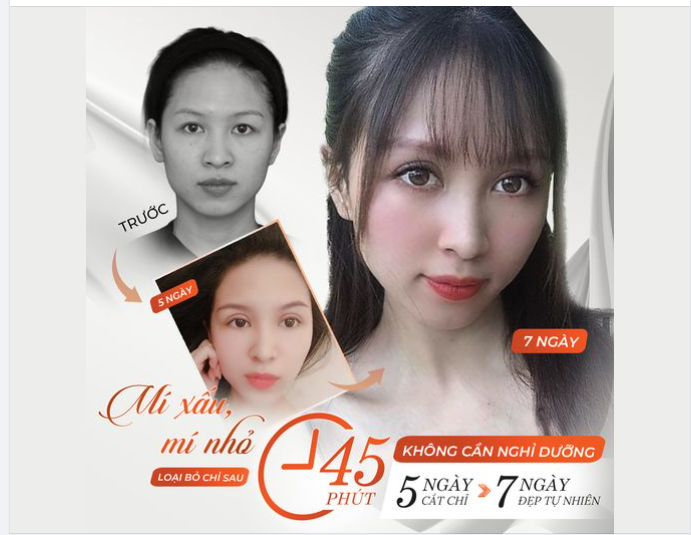 MÍ XẤU, MÍ NHỎ, LOẠI BỎ SAU 45 PHÚT THỰC HIỆN