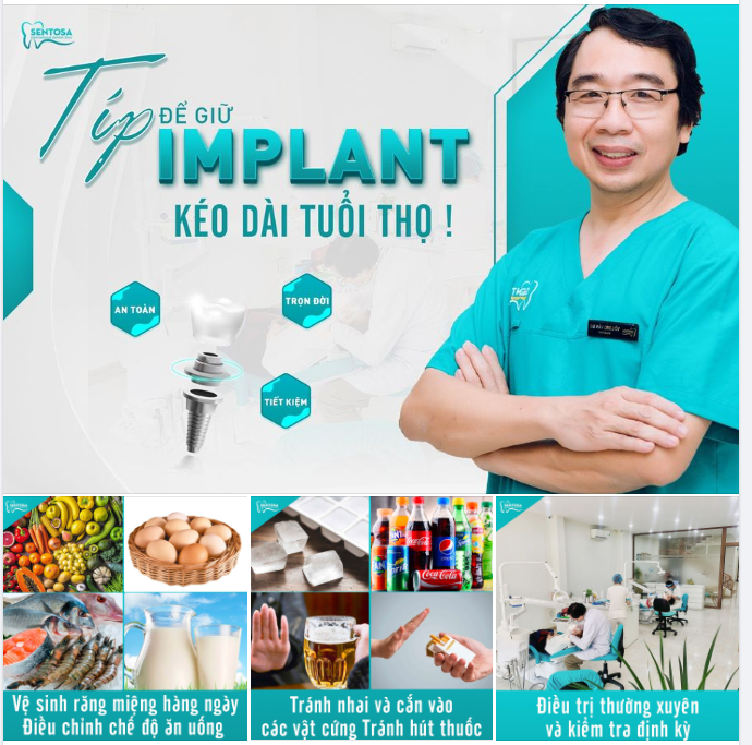 "TÍP" ĐỂ GIỮ IMPLANT KÉO DÀI TUỔI THỌ !