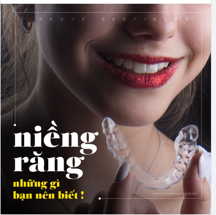 CHUẨN BỊ NIỀNG RĂNG - 9 ĐIỀU QUAN TRỌNG KHÁCH HÀNG CẦN BIẾT!