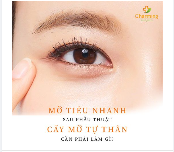 ĐIỀU BẠN CẦN LÀM KHI THẤY MỠ TIÊU BIẾN NHANH SAU PHẪU THUẬT CẤY MỠ MẮT