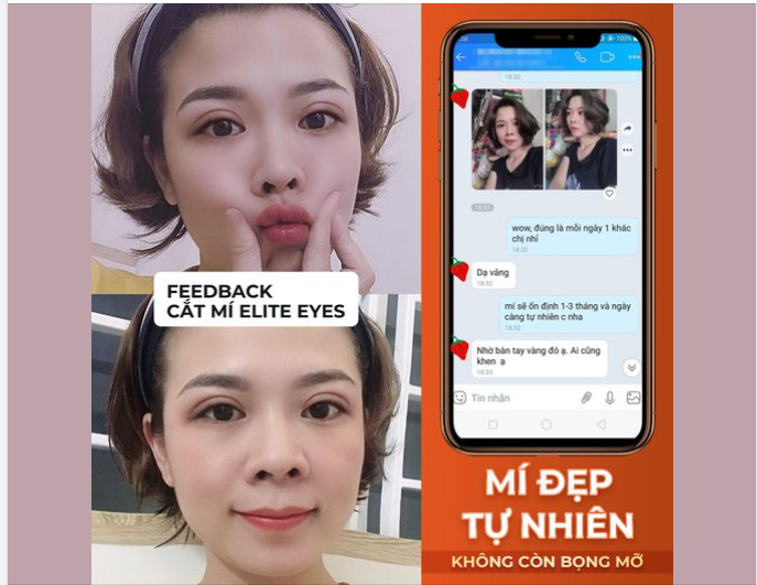 MÍ ĐẸP TỰ NHIÊN, KHÔNG CÒN BỌNG MỠ