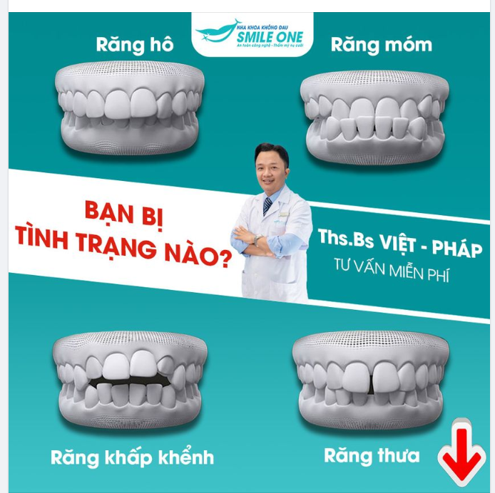 RĂNG HÔ, RĂNG MÓM, RĂNG KHẤP KHỂNH.