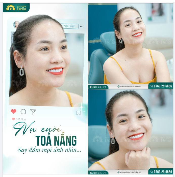 Cảm ơn sự luôn yêu quý, tin tưởng và đồng hành của Quý khách hàng cùng Delia trên hành trình kiến tạo nụ cười đẹp.