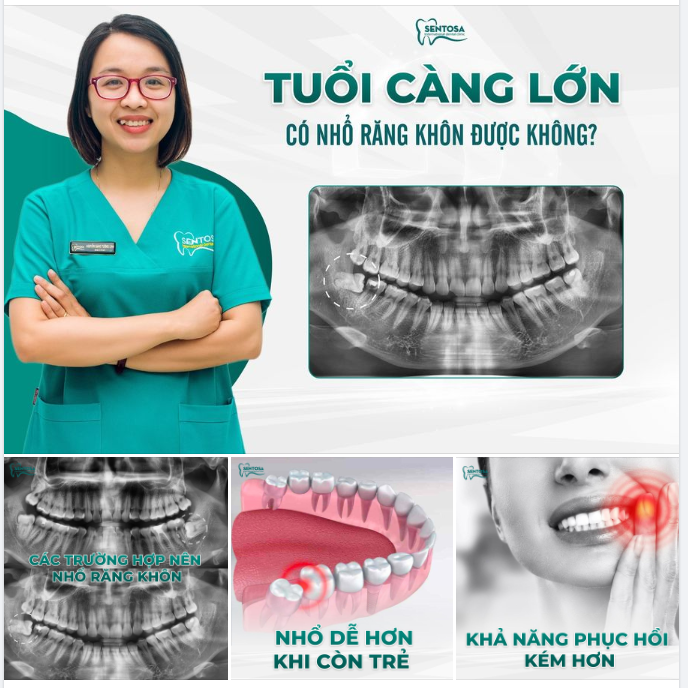 TUỔI CÀNG LỚN CÓ NHỔ RĂNG KHÔN ĐƯỢC KHÔNG?