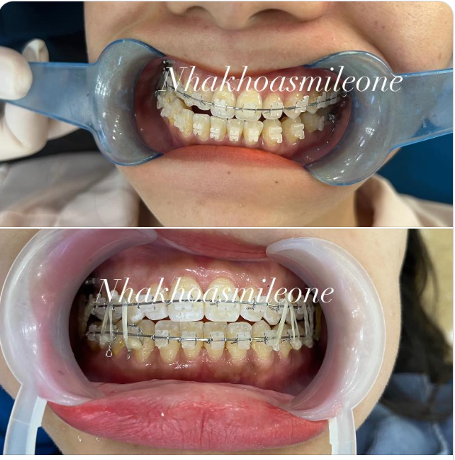 Cảm ơn sự số gắng đến từ 2 chúng ta.  Nguyễn Tuấn Dương