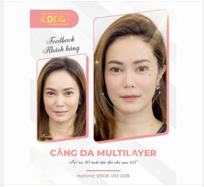 TRẺ HÓA CHUYÊN SÂU​​​​​​​ VỚI KỸ THUẬT ĐỘC QUYỀN