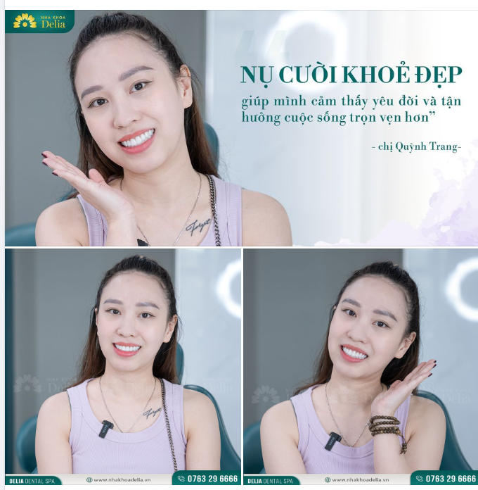 Nụ cười khoẻ đẹp giúp chúng ta cảm thấy yêu đời và tận hưởng cuộc sống trọn vẹn hơn.