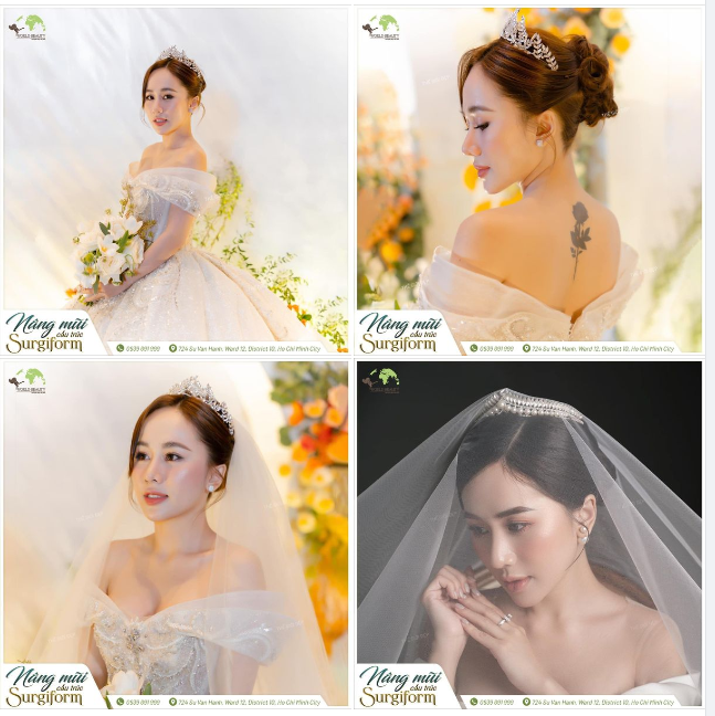 Cận cảnh dung nhan mỹ miều, xinh xắn của quỷ cô sau 4 năm nâng cấp mũi cấu trúc tại Thế Giới Đẹp
