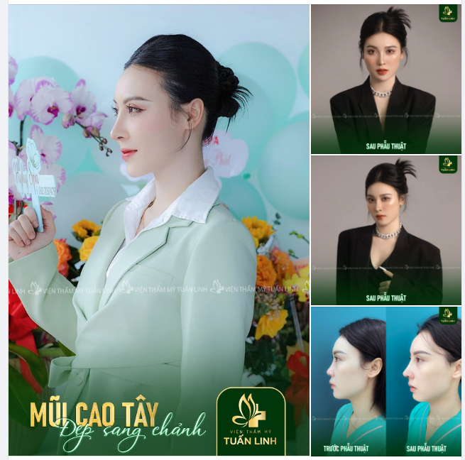 MŨI CAO TÂY CHO GƯƠNG MẶT SANG CHẢNH
