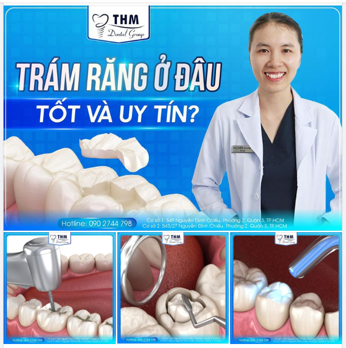 TRÁM RĂNG Ở ĐÂU TỐT VÀ UY TÍN?